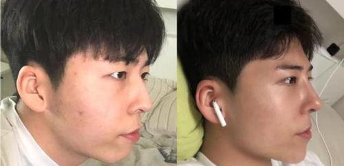 整形爆料视频大全,热门爆料视频大盘点 第1张 整形爆料视频大全,热门爆料视频大盘点 第1张